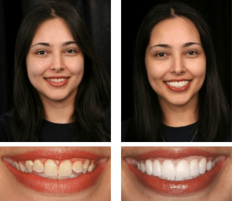 Patient Testimonial Maria | Smile Texas Houston