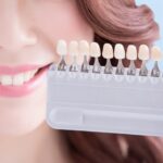 Teeth Whitening Houston Texas | What’s to Blame for Yellowing Teeth?