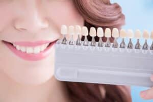 Teeth Whitening Houston Texas | What’s to Blame for Yellowing Teeth?