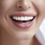 Healthy Smile