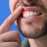 A man with tooth sensitivity pointing to his gums