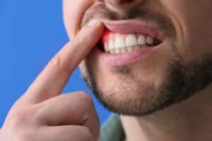 A man with tooth sensitivity pointing to his gums