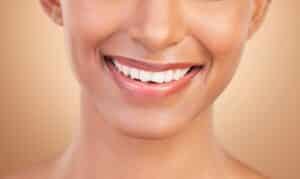 A close-up shot of a woman's smile after Teeth by Tonight® dental implants