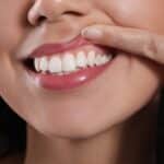 A close-up shot of a woman's smile after GumTuk™ in Sugar Land, TX