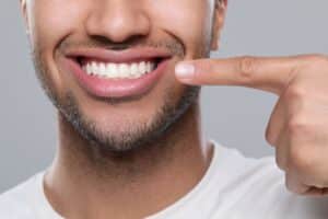 A close-up shot of a man's smile after a GumTuk™ procedure in Sugar Land, TX